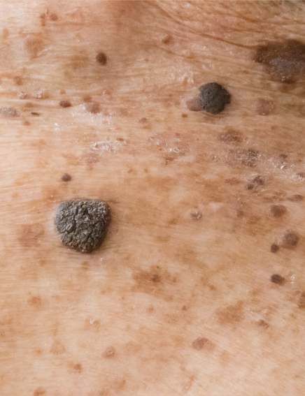 Online Shop - Thuja Skincare-Fluid, 10ml