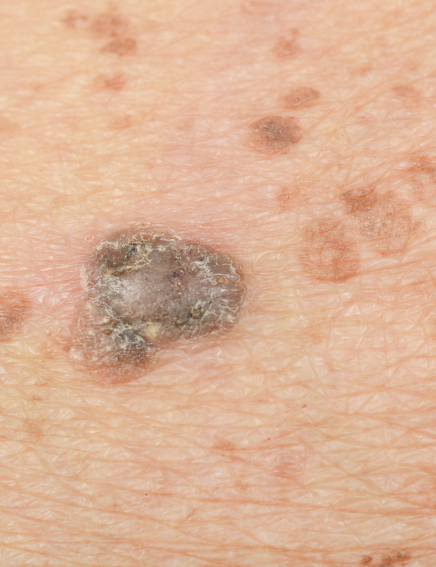 Thuja Skincare-Fluid, 10ml kaufen