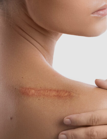 Narbengel, 19g kaufen