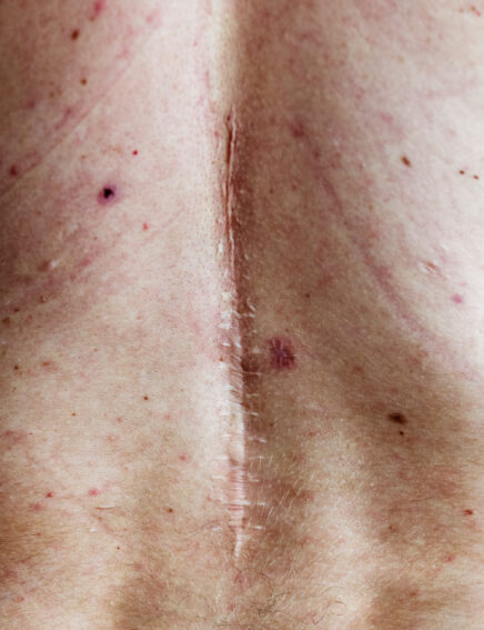 Online Shop - Narbengel, 19g