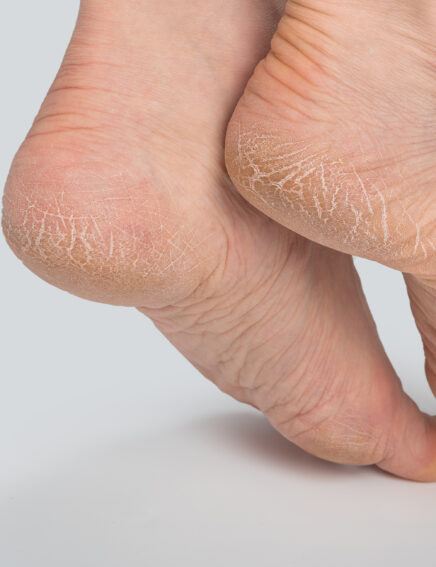 Online Shop - MedoFix, Fersen- und Fingerpflege, 30ml