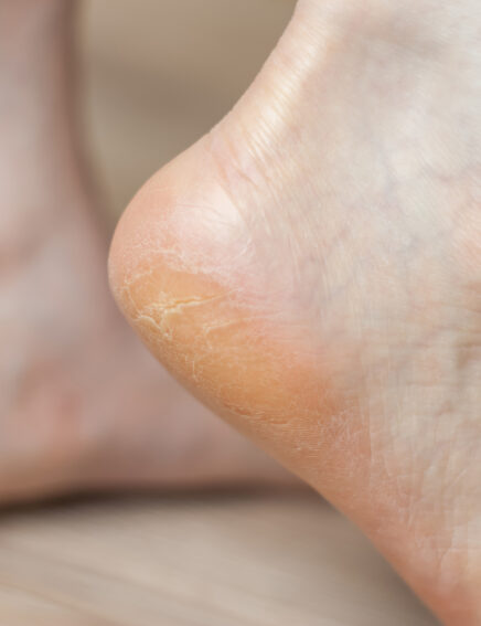 Zimtsohle, Zimt Einlagesohle kaufen