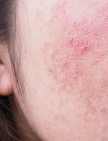 Online Shop - ApricotGold, Bio-Lift Gel, 50ml